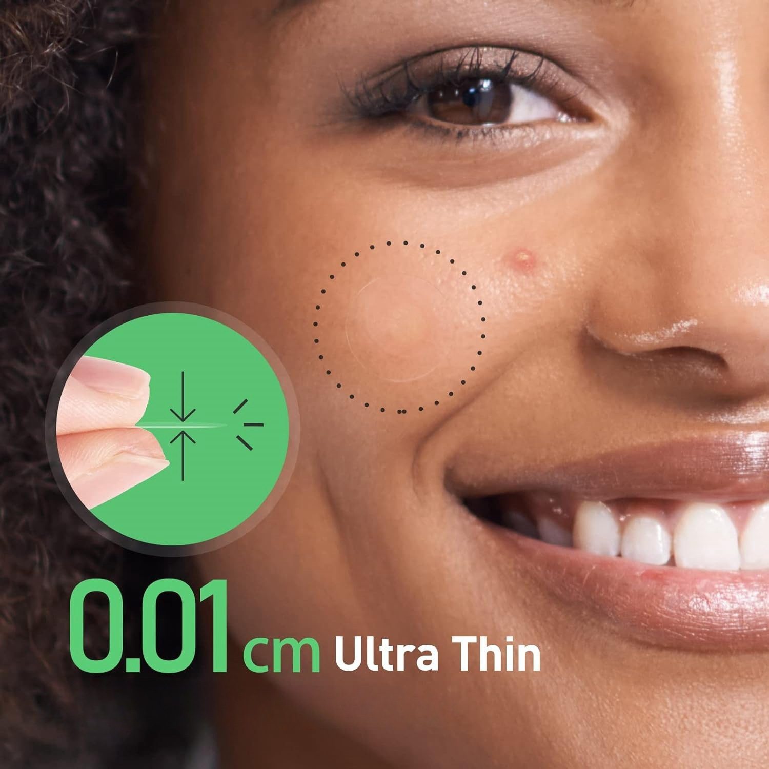 Edge-pressing Pimple Patches Gentle And Waterproof - Image 3