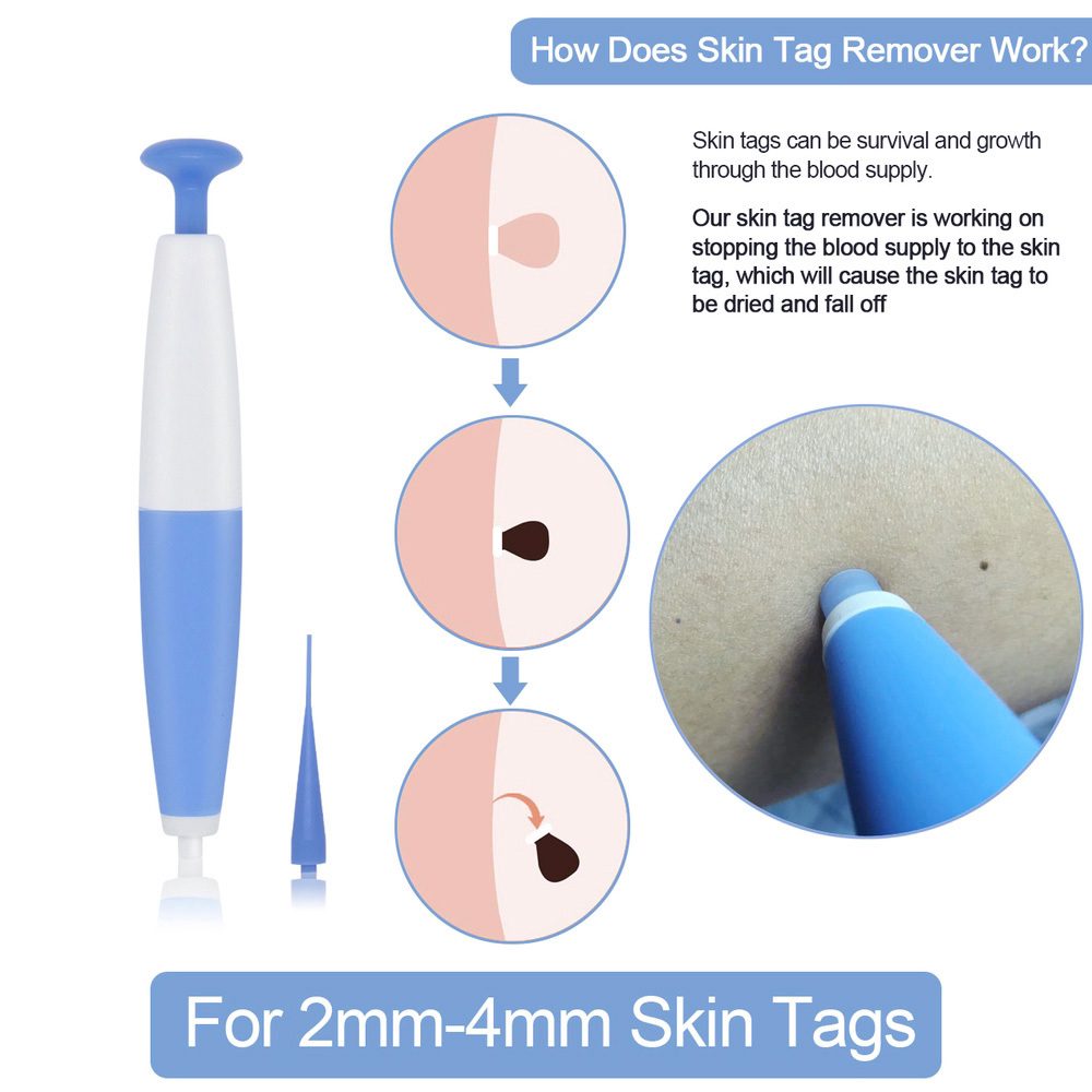 Skin Tag Removal Kit Home Use Mole Wart Remover Micro Band Skin Tag Treatment Tool Easy To Clean Skin Care Tool - Image 2